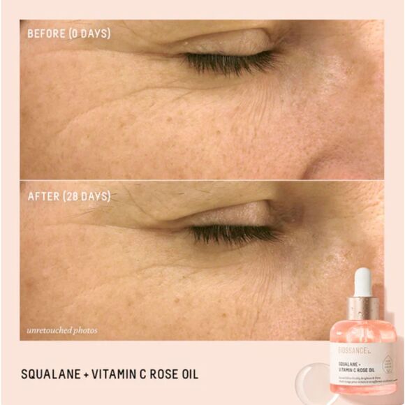 NIB Biossance Squalane + Vitamin C Rose Oil in Limited Edition Packaging - Picture 7 of 12